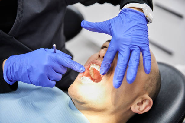 Best Emergency Wisdom Teeth Removal in Web, AL