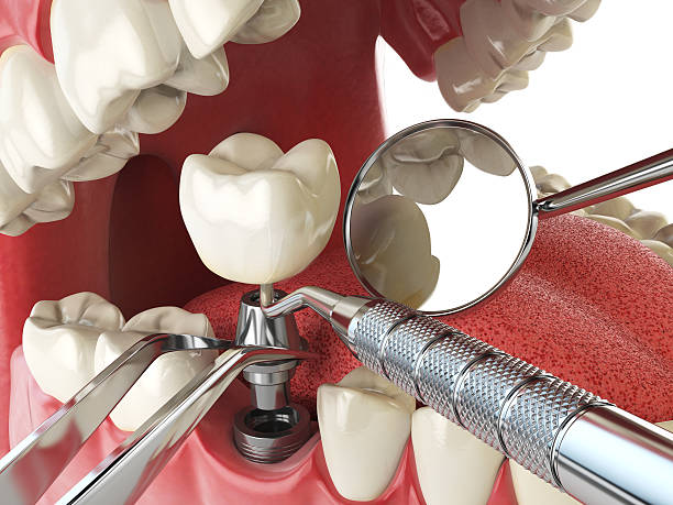 Best Emergency Orthodontic Repairs in Web, AL
